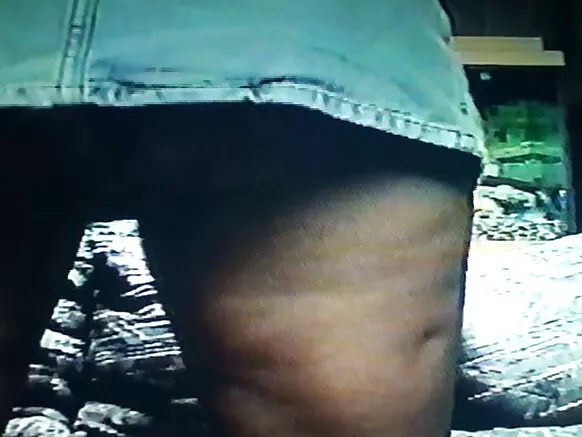 Qullaa bilchaataa mary hd gurraacha keessatti ykn labia majora wajjin.